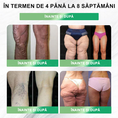 𝐂𝐞𝐫𝐭𝐢𝐟𝐢𝐜𝐚𝐫𝐞 𝐂𝐄|𝐁𝐮𝐢𝐥𝐝𝐋𝐞𝐚𝐟® 𝐆𝐋𝐏-𝟏 𝐒𝐨𝐥𝐮ț𝐢𝐞 𝐨𝐫𝐚𝐥ă 𝟖 î𝐧 𝟏 𝐅𝐢𝐭 & 𝐕𝐢𝐭𝐚𝐥 (𝐃𝐨𝐚𝐫 𝐨 𝐝𝐚𝐭ă 𝐩𝐞 𝐳𝐢, 𝐬𝐜𝐡𝐢𝐦𝐛ă𝐫𝐢 𝐯𝐢𝐳𝐢𝐛𝐢𝐥𝐞 î𝐧 𝟕 𝐳𝐢𝐥𝐞) ✅ 𝐏𝐞𝐧𝐭𝐫𝐮 𝐨𝐛𝐞𝐳𝐢𝐭𝐚𝐭𝐞, 𝐬ă𝐧ă𝐭𝐚𝐭𝐞𝐚 𝐜𝐚𝐫𝐝𝐢𝐨𝐯𝐚𝐬𝐜𝐮𝐥𝐚𝐫ă, 𝐝𝐢𝐚𝐛𝐞𝐭, 𝐚𝐩𝐧𝐞𝐞 î𝐧 𝐬𝐨𝐦𝐧, 𝐬ă𝐧ă𝐭𝐚𝐭𝐞𝐚 𝐢𝐧𝐭𝐞𝐬𝐭𝐢𝐧𝐞𝐥𝐨𝐫, 𝐩𝐫𝐨𝐛𝐥𝐞𝐦𝐞 𝐚𝐫𝐭𝐢𝐜𝐮𝐥𝐚𝐫𝐞 ș𝐢 𝐦𝐮𝐥𝐭𝐞 𝐚𝐥𝐭𝐞𝐥𝐞.