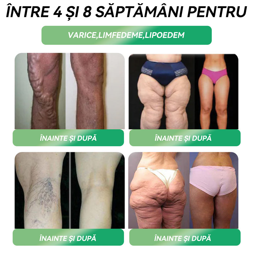 🥇🏥𝗜𝗻𝘀𝘁𝗶𝘁𝘂𝘁𝘂𝗹 𝗖𝗹𝗶𝗻𝗶𝗰 𝗙𝘂𝗻𝗱𝗲𝗻𝗶 𝗥𝗲𝗰𝗼𝗺𝗮𝗻𝗱𝗮𝘁 | 𝗠𝗮𝗴𝗮𝘇𝗶𝗻 𝗼𝗳𝗶𝗰𝗶𝗮𝗹 | 🍀𝑆𝑇𝐷𝐸𝐼® 𝐺𝐿𝑃-1 𝑃𝑖𝑒𝑟𝑑𝑒𝑟𝑒 î𝑛 𝑔𝑟𝑒𝑢𝑡𝑎𝑡𝑒 𝑆𝑜𝑙𝑢ț𝑖𝑒 𝑜𝑟𝑎𝑙ă - 👨‍⚕️ 𝑶𝒃𝒆𝒛𝒊𝒕𝒂𝒕𝒆, 𝒃𝒐𝒍𝒊 𝒄𝒂𝒓𝒅𝒊𝒐𝒗𝒂𝒔𝒄𝒖𝒍𝒂𝒓𝒆, 𝒅𝒊𝒂𝒃𝒆𝒕, 𝒂𝒑𝒏𝒆𝒆 î𝒏 𝒔𝒐𝒎𝒏, 𝒑𝒓𝒐𝒃𝒍𝒆𝒎𝒆 𝒂𝒓𝒕𝒊𝒄𝒖𝒍𝒂𝒓𝒆 ș𝒊 𝒎𝒖𝒍𝒕𝒆 𝒂𝒍𝒕𝒆𝒍𝒆